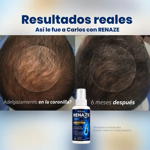 Resultados: Carlos, 6 meses